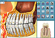Oberon Diagnosebilder Zähne